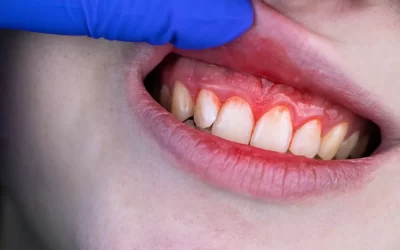 Why do my gums bleed when I brush or floss, and is it a sign of something serious?
